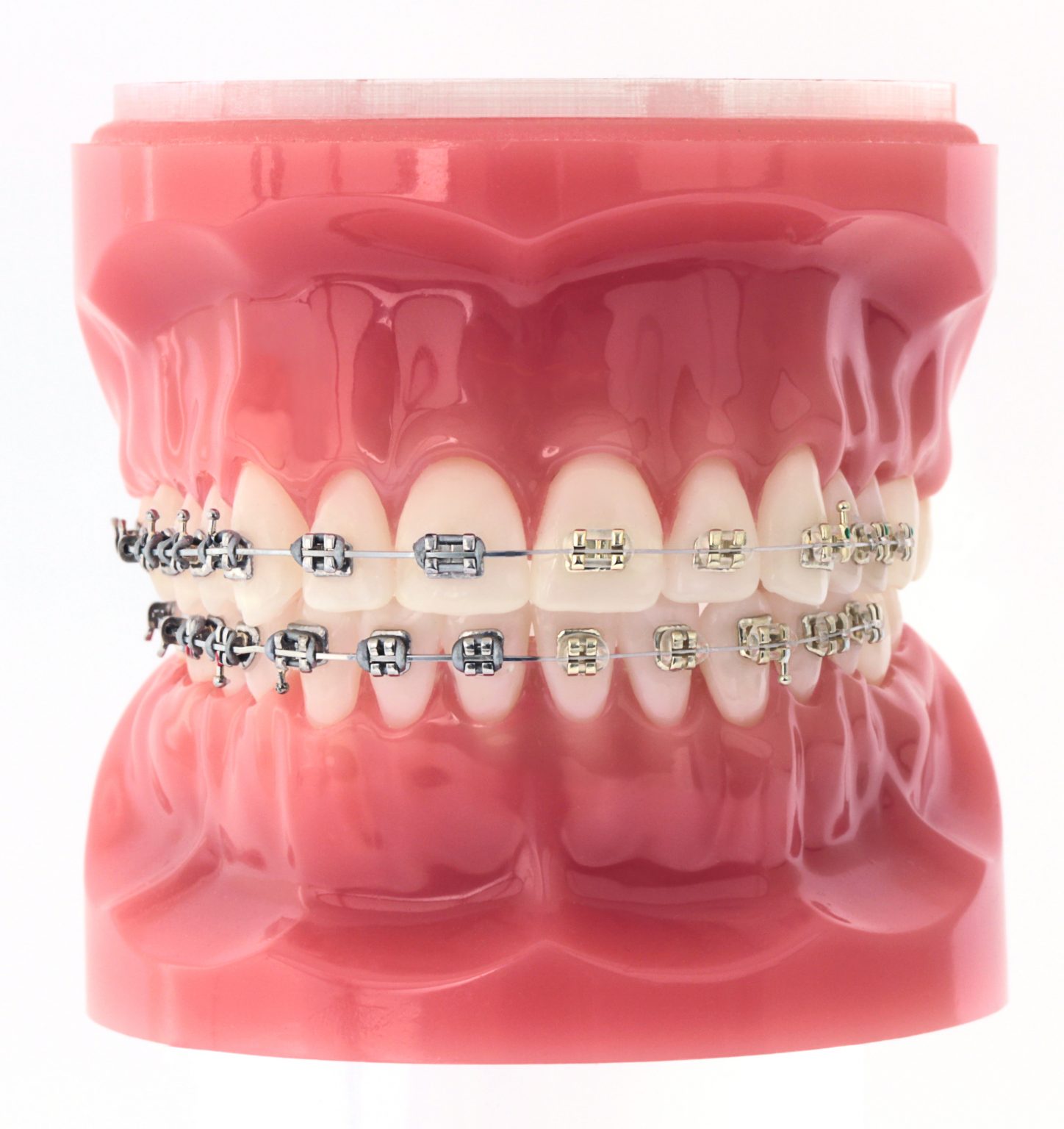 Iconix-BracketComp-1448x1536