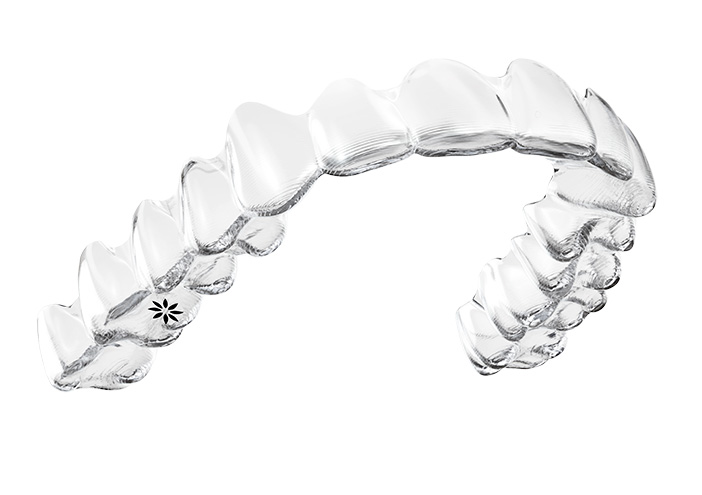 Invisalign-plaatje_k